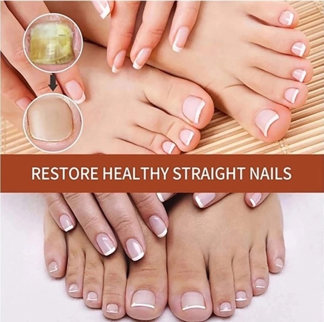 Сыворотка 23001522