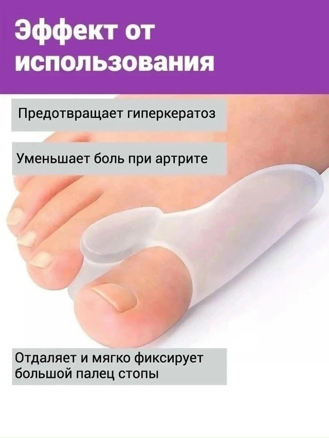 Бурсопротектор бандаж большого пальца 23143742