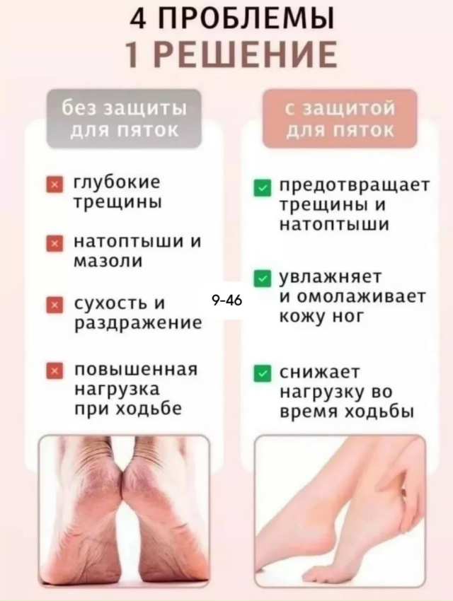 Артикул 23172383